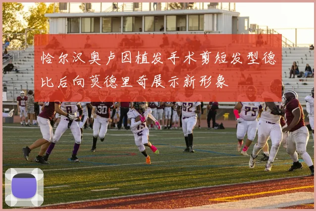 恰尔汉奥卢因植发手术剪短发型德比后向莫德里奇展示新形象